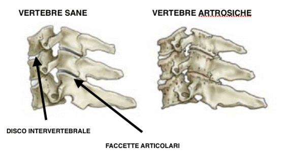 colonna vertebrale 